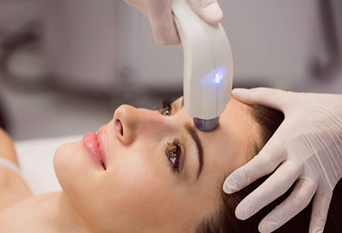 rf-microneedling